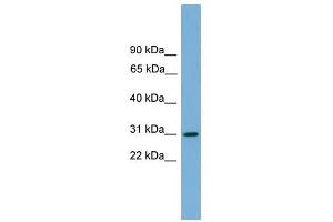 HLA-DQA2 antibody used at 1 ug/ml to detect target protein. (HLA-DQA2 anticorps  (Middle Region))