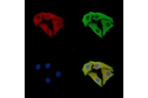 ABIN7095950 and ABIN7100012 staining Hela cells by IF/ICC. (SCYL3 anticorps)