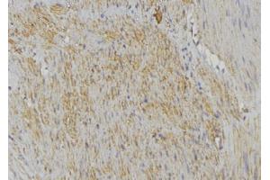 ABIN6274632 at 1/100 staining Mouse muscle tissue by IHC-P.