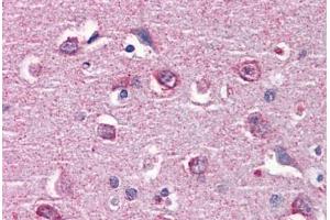 anti-Calcium/calmodulin-Dependent Protein Kinase II beta (CAMK2B) (AA 1-504) antibody