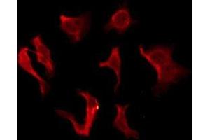 ABIN6276128 staining HeLa by IF/ICC. (OR2B2 anticorps  (Internal Region))
