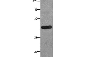 Western Blotting (WB) image for anti-Prostaglandin E Receptor 2 (Subtype EP2), 53kDa (PTGER2) antibody (ABIN2425819) (PTGER2 anticorps)