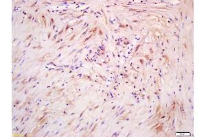 Formalin-fixed and paraffin embedded human myometrium labeled with Anti phospho-ERK5(Ser731+Thr733) Polyclonal Antibody, Unconjugated (ABIN710276) at 1:200 followed by conjugation to the secondary antibody and DAB staining
