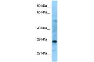 Image no. 1 for anti-Proline Synthetase Co-Transcribed (PROSC) (C-Term) antibody (ABIN6748163)