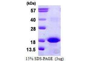 Image no. 1 for BCL2-Related Protein A1 (BCL2A1) protein (His tag) (ABIN6386957)