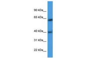 Image no. 1 for anti-Actin Related Protein M1 (ARPM1) (AA 21-70) antibody (ABIN6746783) (ARPM1 anticorps  (AA 21-70))