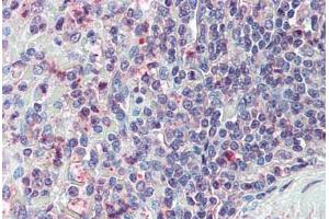 Anti-CD70 antibody  ABIN960751 IHC staining of human spleen.