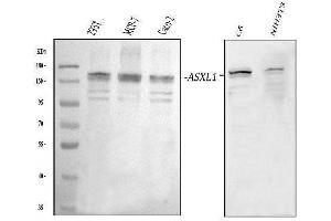 Western blot analysis of ASXL1 using anti-ASXL1 antibody (ABIN5693162). (ASXL1 anticorps)