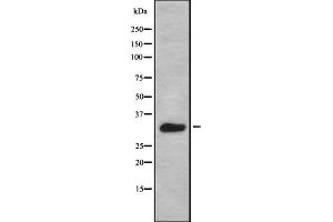 Western blot analysis of BAM32 using HeLa whole cell lysates (DAPP1 anticorps  (Internal Region))