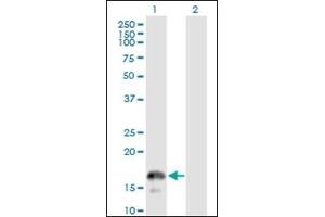 Western Blotting (WB) image for anti-CD247 Molecule (CD247) (AA 1-165) antibody (ABIN782349)