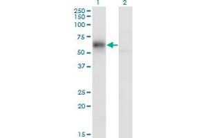 Western Blot analysis of GDI1 expression in transfected 293T cell line by GDI1 monoclonal antibody (M08), clone 1H3. (GDI1 anticorps  (AA 1-447))