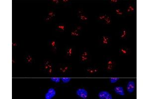 Confocal immunofluorescence analysis of U2OS cells using KRR1 Polyclonal Antibody at dilution of 1:100. (KRR1 anticorps)