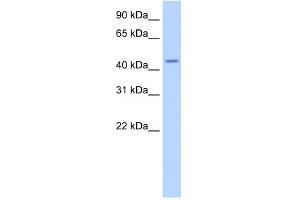WB Suggested Anti-TRNT1 Antibody Titration:  2. (Trnt1 anticorps  (N-Term))