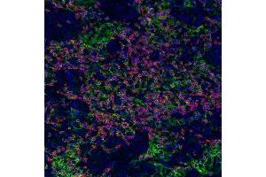 Immunofluorescence (IF) image for anti-CD274 (PD-L1) (C-Term) antibody (ABIN7454042) (Recombinant PD-L1 anticorps  (C-Term))
