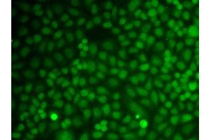 Immunofluorescence analysis of A549 cell using GADD45A antibody. (GADD45A anticorps  (AA 1-165))
