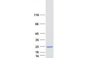 Validation with Western Blot