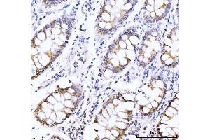 IHC analysis of AKAP 95/AKAP8 using anti-AKAP 95/AKAP8 antibody (ABIN7601553). (AKAP8 anticorps  (AA 380-546))