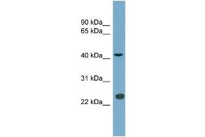 WB Suggested Anti-ART3 Antibody Titration:  0. (ART3 anticorps  (Middle Region))