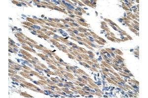 KEAP1 antibody was used for immunohistochemistry at a concentration of 4-8 ug/ml to stain Skeletal muscle cells (arrows) in Human Muscle.