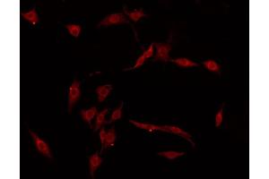 ABIN6274430 staining COLO205 by IF/ICC. (RGAG1 anticorps)