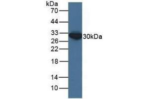 Detection of ECH1 in Human HepG2 Cells using Polyclonal Antibody to Enoyl Coenzyme A Hydratase 1, Peroxisomal (ECH1) (ECH1 anticorps  (AA 1-328))