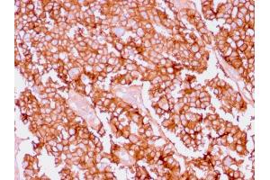 Formalin-fixed, paraffin-embedded human Ovary stained with EpCAM Rabbit Recombinant Monoclonal Antibody (EGP40/1556R).