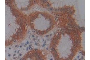 Detection of KDM4A in Human Stomach Tissue using Polyclonal Antibody to Lysine Specific Demethylase 4A (KDM4A) (KDM4A anticorps  (AA 141-310))