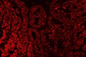 IF analysis of SAP18 using anti-SAP18 antibody (ABIN7599009). (SAP18 anticorps  (AA 1-153))