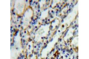 Used in DAB staining on fromalin fixed paraffin-embedded Spleen tissue