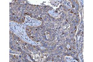 IHC analysis of CCNB1 using anti-CCNB1 antibody (ABIN7599335). (Cyclin B1 anticorps  (AA 1-383))