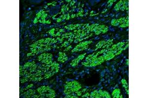 IF analysis of TAGLN/Transgelin using anti-TAGLN/Transgelin antibody (ABIN7600099).