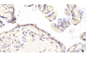 Detection of PAI1 in Human Placenta Tissue using Monoclonal Antibody to Plasminogen Activator Inhibitor 1 (PAI1)