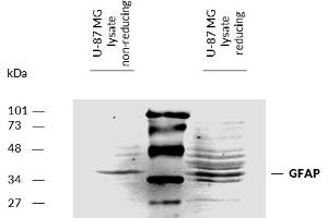 Detection of Glial fibrillary acidic protein (GFAP) by Western Blot. (GFAP anticorps)