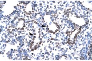 anti-Ha-Ry/enhancer-of-Split Related with YRPW Motif 1 (HEY1) (C-Term) antibody