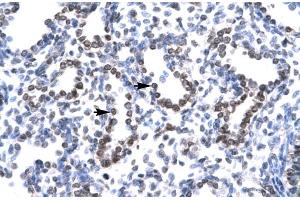 Immunohistochemistry (IHC) image for anti-Ha-Ry/enhancer-of-Split Related with YRPW Motif 1 (HEY1) (C-Term) antibody (ABIN2779686) (HEY1 anticorps  (C-Term))