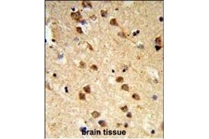 Formalin-fixed and paraffin-embedded human brain tissue reacted with ATXN3 Antibody (Center), which was peroxidase-conjugated to the secondary antibody, followed by DAB staining.