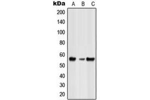 Western blot analysis of GLRB expression in HeLa (A), NIH3T3 (B), rat spleen (C) whole cell lysates. (GLRB anticorps  (Center))