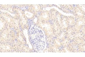 Detection of a2PI in Human Kidney Tissue using Polyclonal Antibody to Alpha 2-Antiplasmin (a2PI) (a2PI anticorps)
