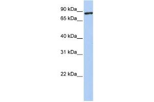 WB Suggested Anti-TMEM63A Antibody Titration:  0. (TMEM63A anticorps  (N-Term))