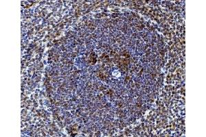 IHC analysis of Rad9/Rad9a using anti-Rad9/Rad9a antibody (ABIN7599342). (RAD9A anticorps  (AA 1-389))