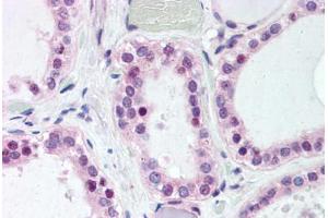 Anti-WNT4 antibody  ABIN1049477 IHC staining of human thyroid.