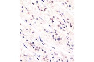 C staining CDC73 in human adrenal gland tissue sections by Immunohistochemistry (IHC-P - paraformaldehyde-fixed, paraffin-embedded sections).