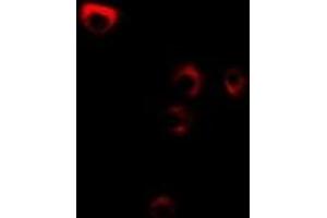 Immunofluorescent analysis of FDFT1 staining in MCF7 cells. (FDFT1 anticorps)