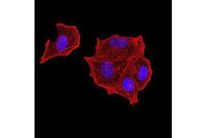 Immunofluorescence analysis of Hela cells using PTPN14 mouse mAb. (PTPN14 anticorps  (AA 896-1169))