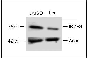 Western blot analysis of extracts from MM cells, treated with DMSO or lenalidomide, using rabbit polyclonal IKZF3 Antibody . (IKZF3 anticorps  (AA 76-103))