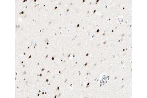 ABIN6266945 at 1/100 staining human brain tissue sections by IHC-P. (p300 anticorps  (Internal Region))