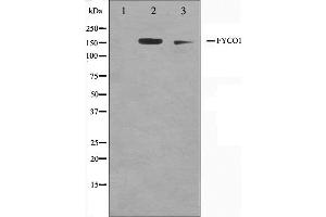 Western blot analysis on A549 and HuvEc cell lysate using FYCO1 Antibody,The lane on the left is treated with the antigen-specific peptide. (FYCO1 anticorps  (Internal Region))