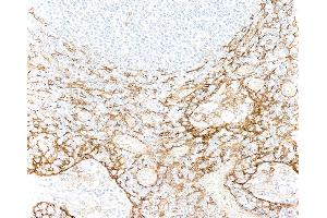 Immunohistochemistry (IHC) image for anti-Thrombomodulin (THBD) (AA 17-515) antibody (ABIN7795643)