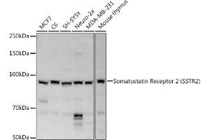 Western blot analysis of extracts of various cell lines, using Somatostatin Receptor 2 (SSTR2) antibody (ABIN3017442, ABIN3017443, ABIN3017444 and ABIN6220093) at 1:1000 dilution. (SSTR2 anticorps  (C-Term))