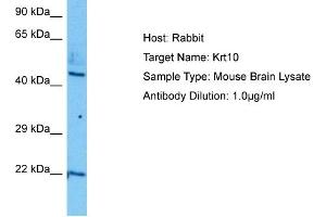 Host:  Mouse  Target Name:  KRT10  Sample Tissue:  Mouse Brain  Antibody Dilution:  1ug/ml (Keratin 10 anticorps  (N-Term))